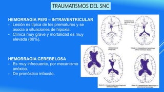 TRAUMATISMOS DEL SNC
HEMORRAGIA PERI – INTRAVENTRICULAR
- Lesión es típica de los prematuros y se
asocia a situaciones de hipoxia.
- Clínica muy grave y mortalidad es muy
elevada (80%).
HEMORRAGIA CEREBELOSA
- Es muy infrecuente, por mecanismo
anóxico.
- De pronóstico infausto.
 