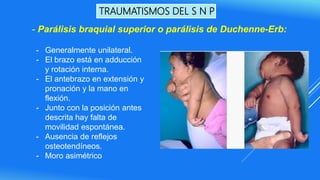 TRAUMATISMOS DEL S N P
- Generalmente unilateral.
- El brazo está en adducción
y rotación interna.
- El antebrazo en extensión y
pronación y la mano en
flexión.
- Junto con la posición antes
descrita hay falta de
movilidad espontánea.
- Ausencia de reflejos
osteotendíneos.
- Moro asimétrico
- Parálisis braquial superior o parálisis de Duchenne-Erb:
 