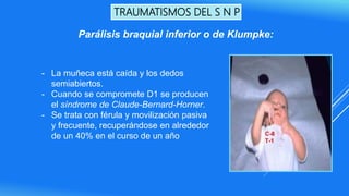 TRAUMATISMOS DEL S N P
- La muñeca está caída y los dedos
semiabiertos.
- Cuando se compromete D1 se producen
el síndrome de Claude-Bernard-Horner.
- Se trata con férula y movilización pasiva
y frecuente, recuperándose en alrededor
de un 40% en el curso de un año
Parálisis braquial inferior o de Klumpke:
 