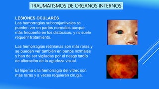 TRAUMATISMOS DE ORGANOS INTERNOS
LESIONES OCULARES
Las hemorragias subconjuntivales se
pueden ver en partos normales aunque
más frecuente en los distócicos, y no suele
requerir tratamiento.
Las hemorragias retinianas son más raras y
se pueden ver también en partos normales
y han de ser vigiladas por el riesgo tardío
de alteración de la agudeza visual.
El hipema o la hemorragia del vítreo son
más raras y a veces requieren cirugía.
 