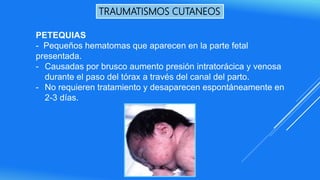 TRAUMATISMOS CUTANEOS
PETEQUIAS
- Pequeños hematomas que aparecen en la parte fetal
presentada.
- Causadas por brusco aumento presión intratorácica y venosa
durante el paso del tórax a través del canal del parto.
- No requieren tratamiento y desaparecen espontáneamente en
2-3 días.
 