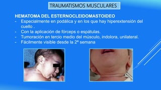 TRAUMATISMOS MUSCULARES
HEMATOMA DEL ESTERNOCLEIDOMASTOIDEO
- Especialmente en podálica y en los que hay hiperextensión del
cuello .
- Con la aplicación de fórceps o espátulas.
- Tumoración en tercio medio del músculo, indolora, unilateral.
- Fácilmente visible desde la 2ª semana
 