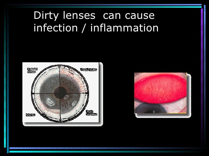 care and maintenance of soft contact lenses