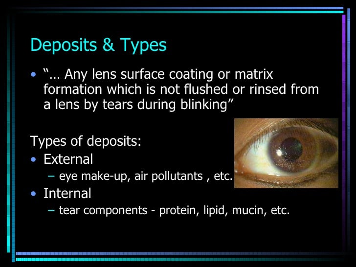 care and maintenance of soft contact lenses