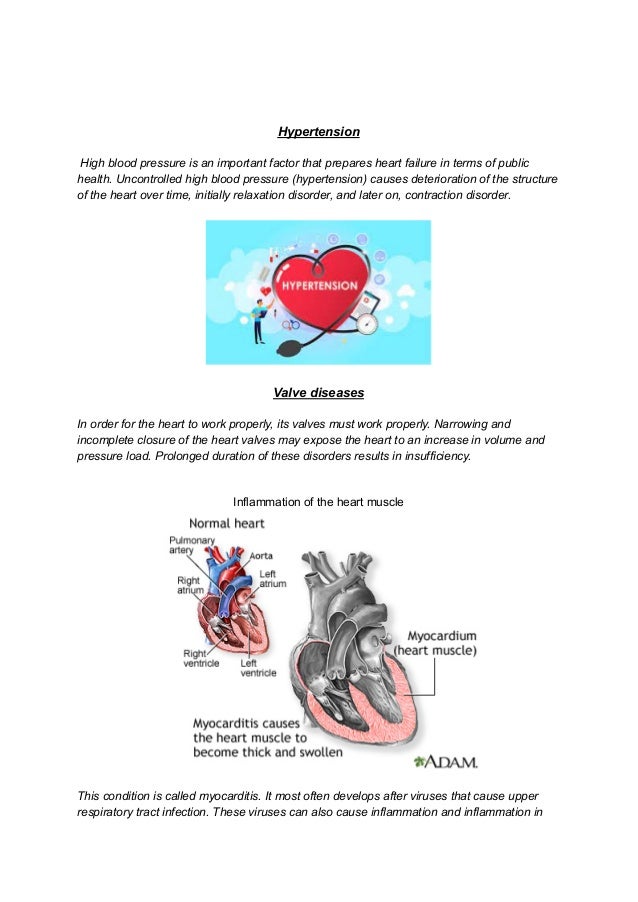 Causes Of Heart Failure Pdf , 10 Things to Know About Heart Failure ...