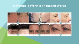 A Picture is Worth a Thousand Words
Before After Before After Before After
Before After Before After Before After
 