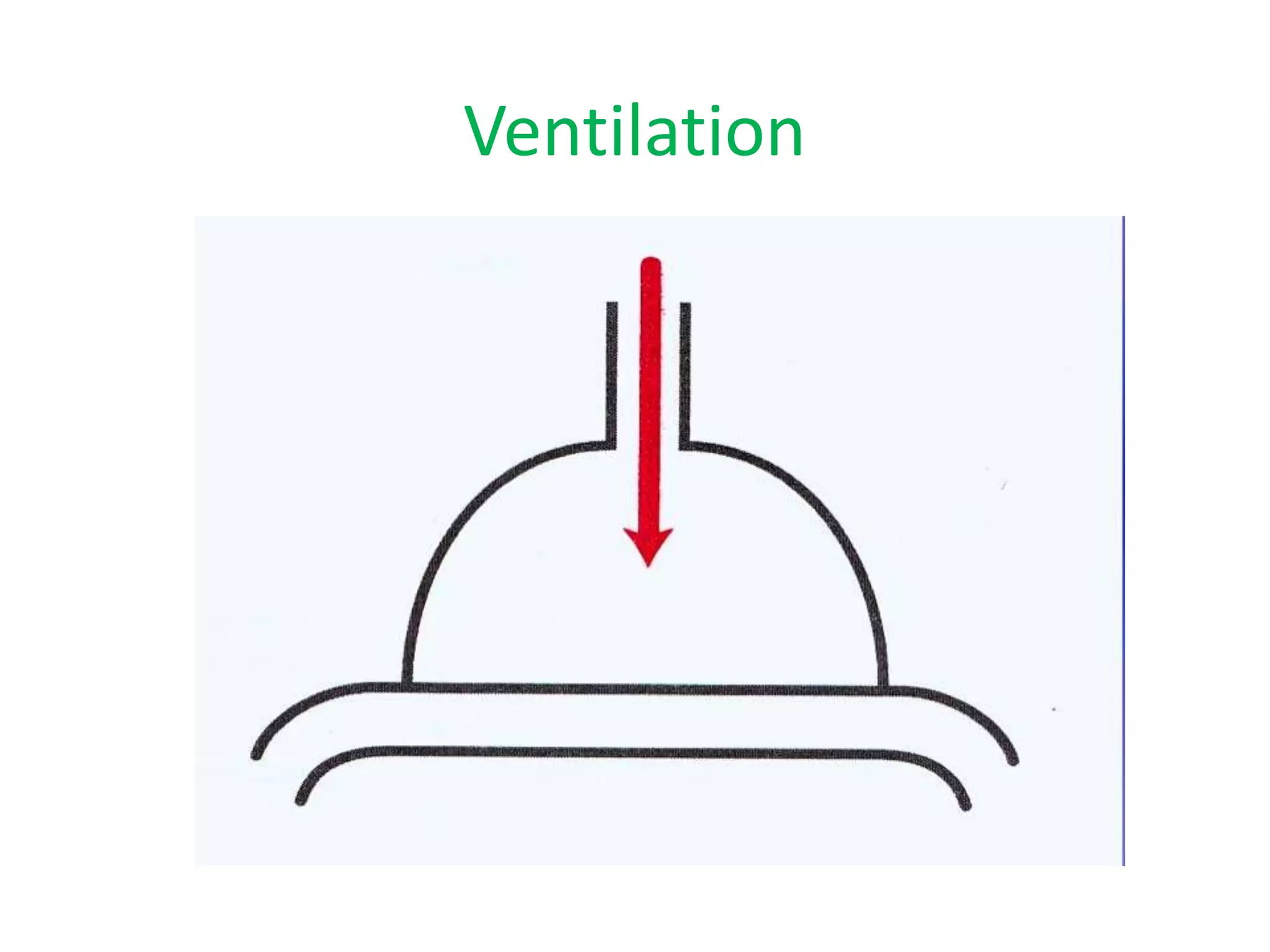 Ventilation
 