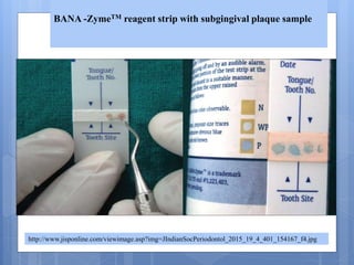 http://www.jisponline.com/viewimage.asp?img=JIndianSocPeriodontol_2015_19_4_401_154167_f4.jpg
BANA -ZymeTM reagent strip with subgingival plaque sample
 
