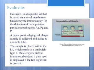 Evalusite4
1. Evalusite is a diagnostic kit that
is based on a novel membrane-
based enzyme immunoassay for
the detection of three putative
periodontopathogens: Aa, Pg and
Pi.
2. A paper point subgingival plaque
sample is collected and added to
a sample tube.
3. The sample is placed within the
kit, which employs a sandwich-
type ELISA (enzyme-linked
immunosorbent)and a pink spot
is displayed if the test organism
is present.
 