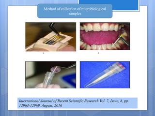 Method of collection of microbiological
samples
International Journal of Recent Scientific Research Vol. 7, Issue, 8, pp.
12963-12969, August, 2016
 