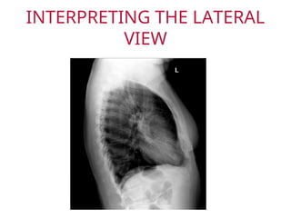 Respiratory medicine dept Chest X-Ray.ppt