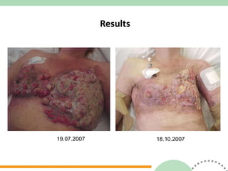 Results 19.07.2007 18.10.2007 