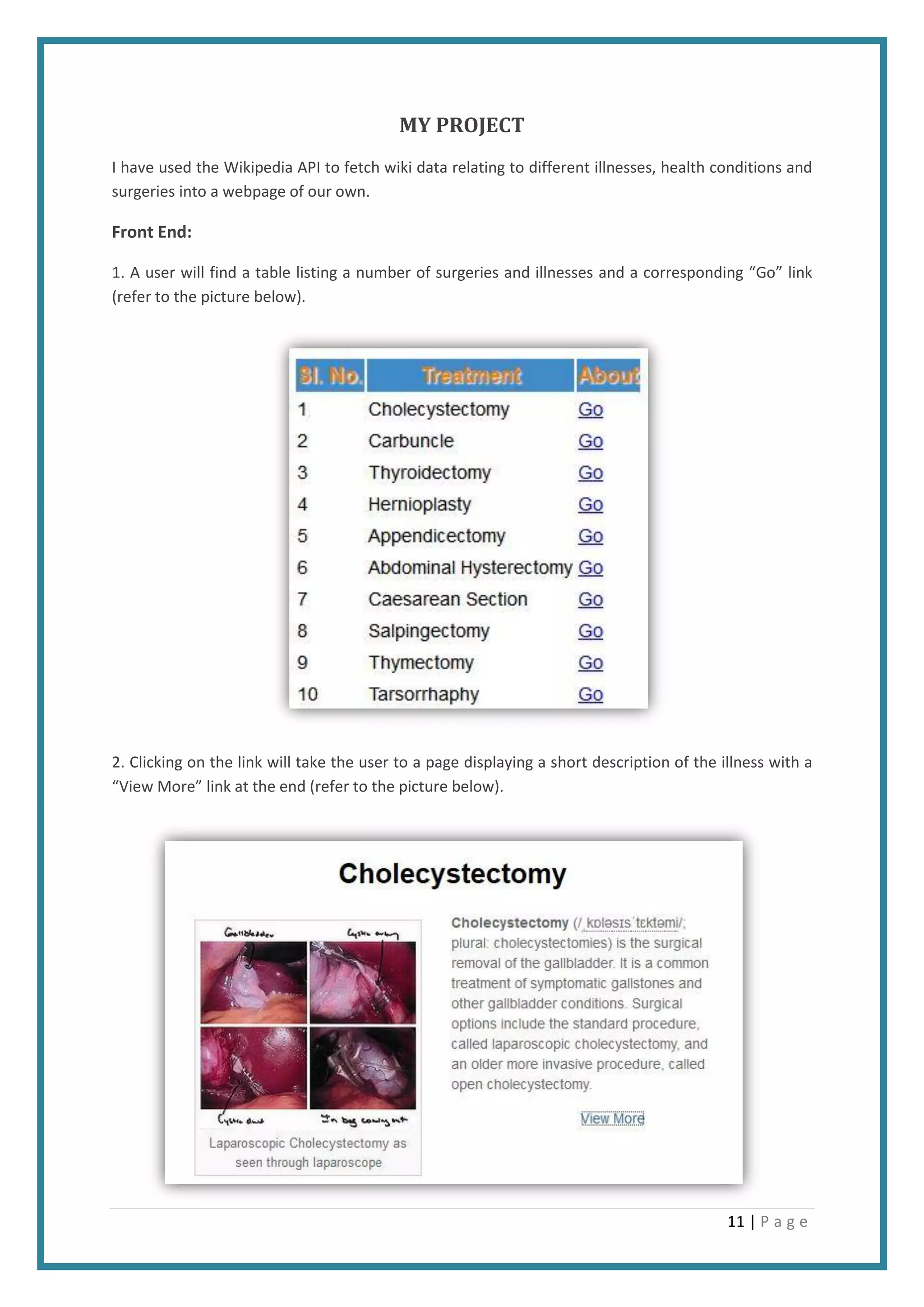 11 | P a g e
MY PROJECT
I have used the Wikipedia API to fetch wiki data relating to different illnesses, health conditions and
surgeries into a webpage of our own.
Front End:
1. A user will find a table listing a number of surgeries and illnesses and a corresponding “Go” link
(refer to the picture below).
2. Clicking on the link will take the user to a page displaying a short description of the illness with a
“View More” link at the end (refer to the picture below).
 