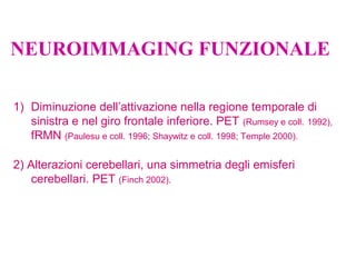 NEUROIMMAGING FUNZIONALE
1) Diminuzione dell’attivazione nella regione temporale di
sinistra e nel giro frontale inferiore. PET (Rumsey e coll. 1992),
fRMN (Paulesu e coll. 1996; Shaywitz e coll. 1998; Temple 2000).
2) Alterazioni cerebellari, una simmetria degli emisferi
cerebellari. PET (Finch 2002).
 
