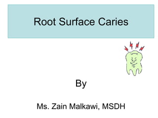 Root Surface Caries
By
Ms. Zain Malkawi, MSDH
 