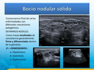 Consecuencia final de varias
enfermedades con
diferentes mecanismos
patogénicos.
DEFINIMOS NODULO:
Como masas localizadas de
consistencia generalmente
firme y diferenciadas dentro
de la glándula.
1º.- HOMOGENEOS :
a- hipoecoicos.
b- isoecoicos.
c- hiperecoicos
 