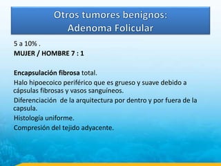 5 a 10% .
MUJER / HOMBRE 7 : 1
Encapsulación fibrosa total.
Halo hipoecoico periférico que es grueso y suave debido a
cápsulas fibrosas y vasos sanguíneos.
Diferenciación de la arquitectura por dentro y por fuera de la
capsula.
Histología uniforme.
Compresión del tejido adyacente.
 