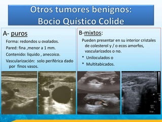A- puros
Forma: redondos u ovalados.
Pared: fina ,menor a 1 mm.
Contenido: liquido , anecoico.
Vascularización: solo periférica dado
por finos vasos.
B-mixtos:
Pueden presentar en su interior cristales
de colesterol y / o ecos amorfos,
vascularizados o no.
* Uniloculados o
* Multitabicados.
 