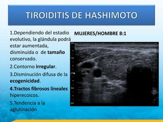 1.Dependiendo del estadio
evolutivo, la glándula podrá
estar aumentada,
disminuida o de tamaño
conservado.
2.Contorno irregular.
3.Disminución difusa de la
ecogenicidad.
4.Tractos fibrosos lineales
hiperecoicos.
5.Tendencia a la
aglutinación
MUJERES/HOMBRE 8:1
 