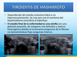 • Dependiendo del estadio evolutivo habrá o no
hipervascularización. Se cree que con el comienzo del
hipotiroidismo coincidiría el hiperflujo.
• El estadio final de la enfermedad es una atrofia con una
glándula pequeña, de márgenes mal definidos y textura
heterogénea debido al incremento progresivo de la fibrosis
no demostrándose flujo sanguíneo interno.
 