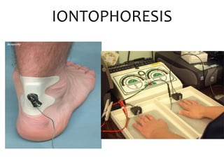 IONTOPHORESIS
 