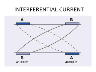 INTERFERENTIAL CURRENT
 
