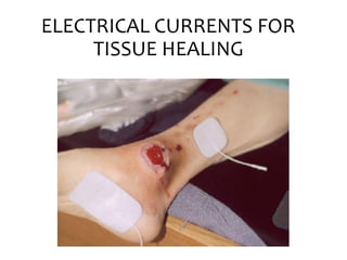 ELECTRICAL CURRENTS FOR
TISSUE HEALING
 