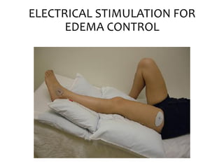 ELECTRICAL STIMULATION FOR
EDEMA CONTROL
 