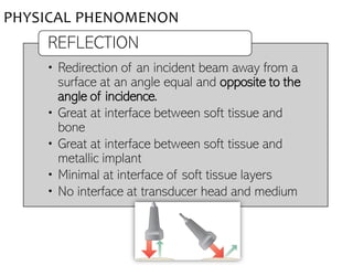 PHYSICAL PHENOMENON
• Redirection of an incident beam away from a
surface at an angle equal and opposite to the
angle of incidence.
• Great at interface between soft tissue and
bone
• Great at interface between soft tissue and
metallic implant
• Minimal at interface of soft tissue layers
• No interface at transducer head and medium
REFLECTION
 