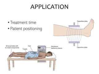 APPLICATION
• Treatment time
• Patient positioning
 