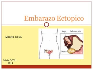 Embarazo Ect0pico 
MIGUEL SILVA 
26 de OCTU. 
2014 
 