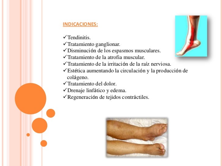 INDICACIONES Y CONTRAINDICACIONES DE LA ELECTROTERAPIA PDF