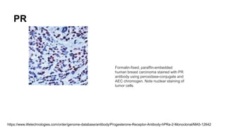 IHC Markers and Antibodies | PPTX
