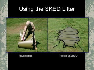 Evacuation Using a SKED or Improvised LitterCombat Trauma Treatment14
Using the SKED Litter
Reverse RollReverse Roll Flatten SKEDCOFlatten SKEDCO
 