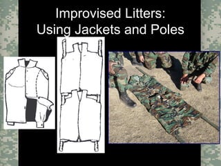 Evacuation Using a SKED or Improvised LitterCombat Trauma Treatment23
Improvised Litters:
Using Jackets and Poles
 