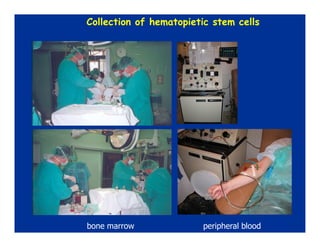 Hematopoietic stem cell transplantation in Pediatrics | PDF
