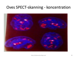 Oves SPECT-skanning - koncentration




             http://relationskunskap.com   30
 