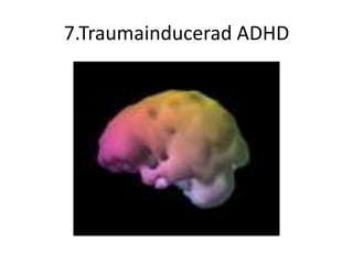 7.Traumainducerad ADHD
 