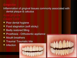 Gingivitis
Inflammation of gingival tissues commonly associated with
   dental plaque & calculus
Acute gingivitis
Causes: Local
 Poor dental hygiene
 Food stagnation (soft sticky)
 Badly restored filling
 Prosthesis - Orthodontic appliance
 Mouth breathers
 Trauma/ Traumatic bite
 Infection



                          Dr S Chakradhar                   1
 