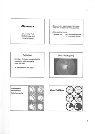 Glaucoma and management