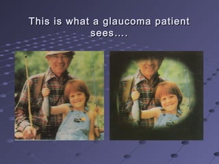 This is what a glaucoma patientThis is what a glaucoma patient
sees….sees….
 