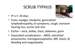 SCRUB TYPHUS
• IP is 5 -20 days
• Fever, myalgia, headache, generalized
lymphadenopathy, GI symptoms, cough, transient
hearing loss, eschar and rash
• Eschar – neck, axillae, chest, abdomen, groin
• Associated complications – ARDS, interstitial
pneumonitis, meningoencephalitis, ARF, shock, GI
bleeding and coagulopathy
 