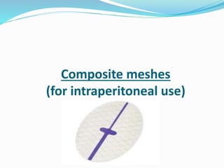 Composite meshes
(for intraperitoneal use)
 