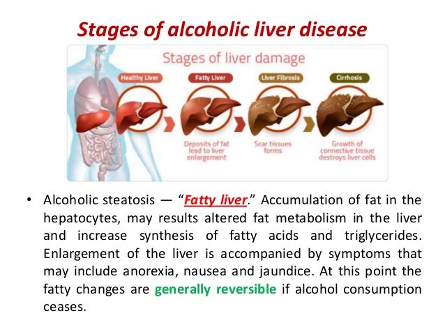 liver failure stages infective hepatitis and cirrhosis liver failure stages infective hepatitis and cirrhosis