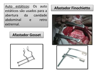 Auto estáticos: Os auto
estáticos são usados para a
abertura da cavidade
abdominal e retro
extrernal.
Afastador Finochietto
Afastador Gosset
 