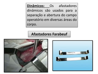 Dinâmicos: Os afastadores
dinâmicos são usados para a
separação e abertura do campo
operatório em diversas áreas do
corpo.
Afastadores Farabeuf
 
