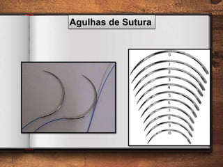 Agulhas de Sutura
 