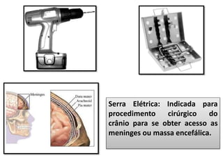 Serra Elétrica: Indicada para
procedimento cirúrgico do
crânio para se obter acesso as
meninges ou massa encefálica.
 