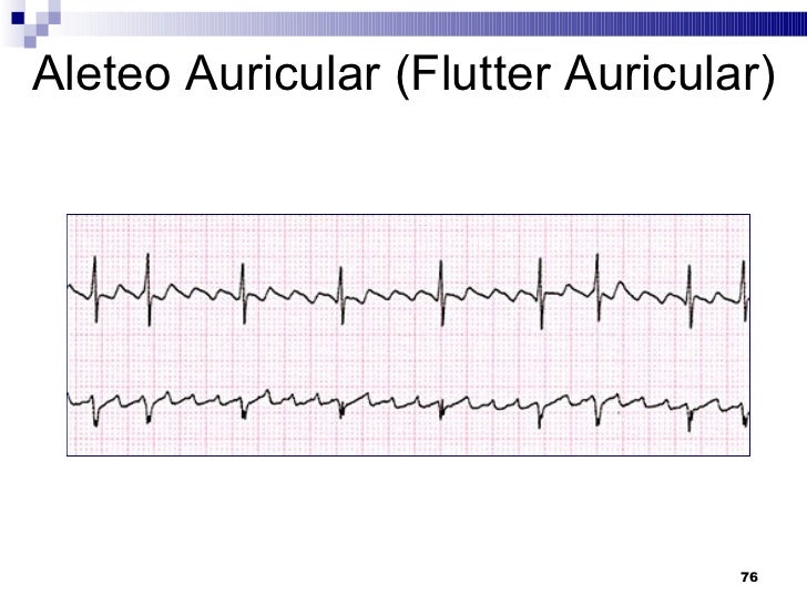 Abordaje sistematico a la interpretación del EKG