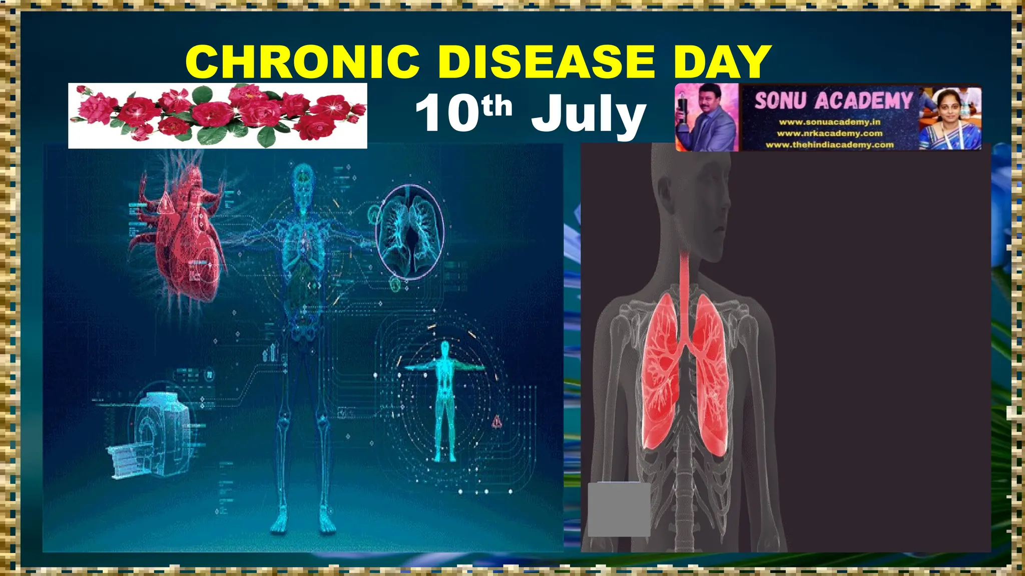 10th
July
CHRONIC DISEASE DAY
 